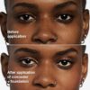 Brighten and Perfect – Clinique Even Better Concealer